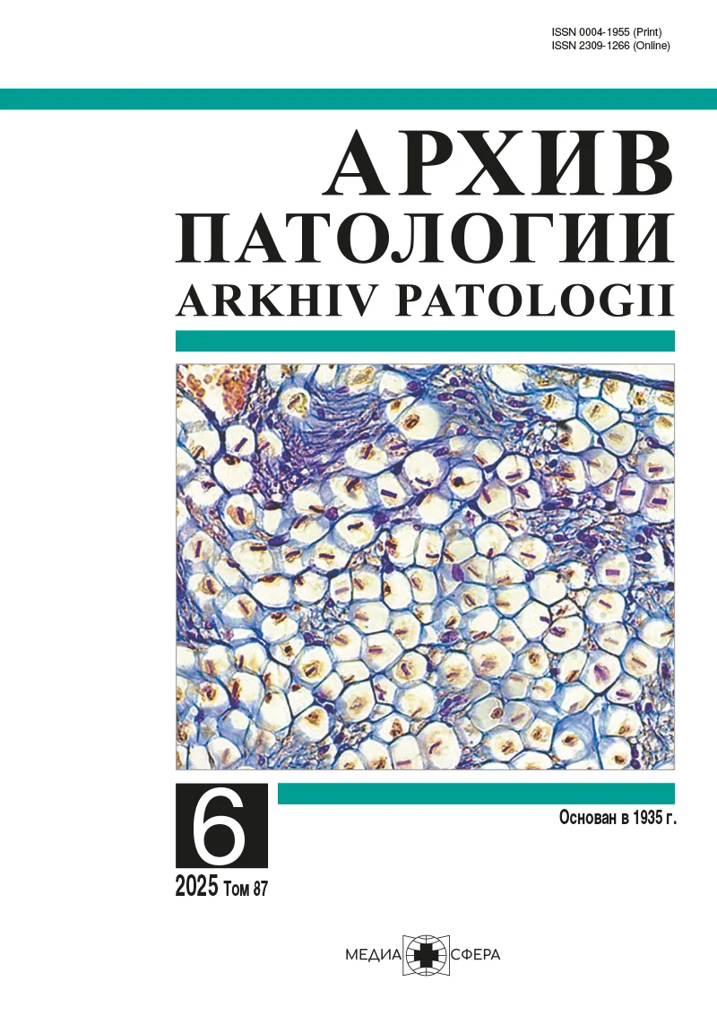 Диспластические невусы: сложности диагностики