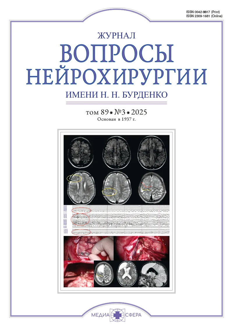 Клинический случай комбинированного хирургического лечения эксцентрично-фузиформной аневризмы проксимального отдела основной артерии и обзор литературы
