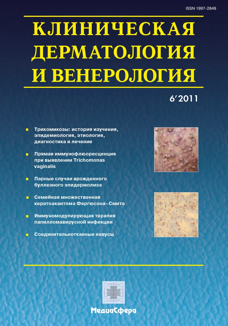Иммуномодулирующая терапия папилломавирусной инфекции