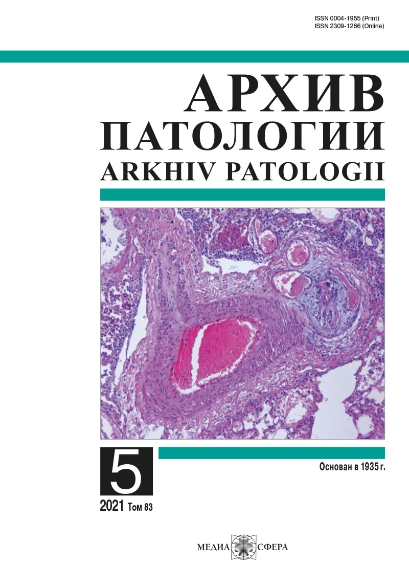 Памяти Ирины Сергеевны Дерижановой (8 августа 1937 — 25 июля 2021)