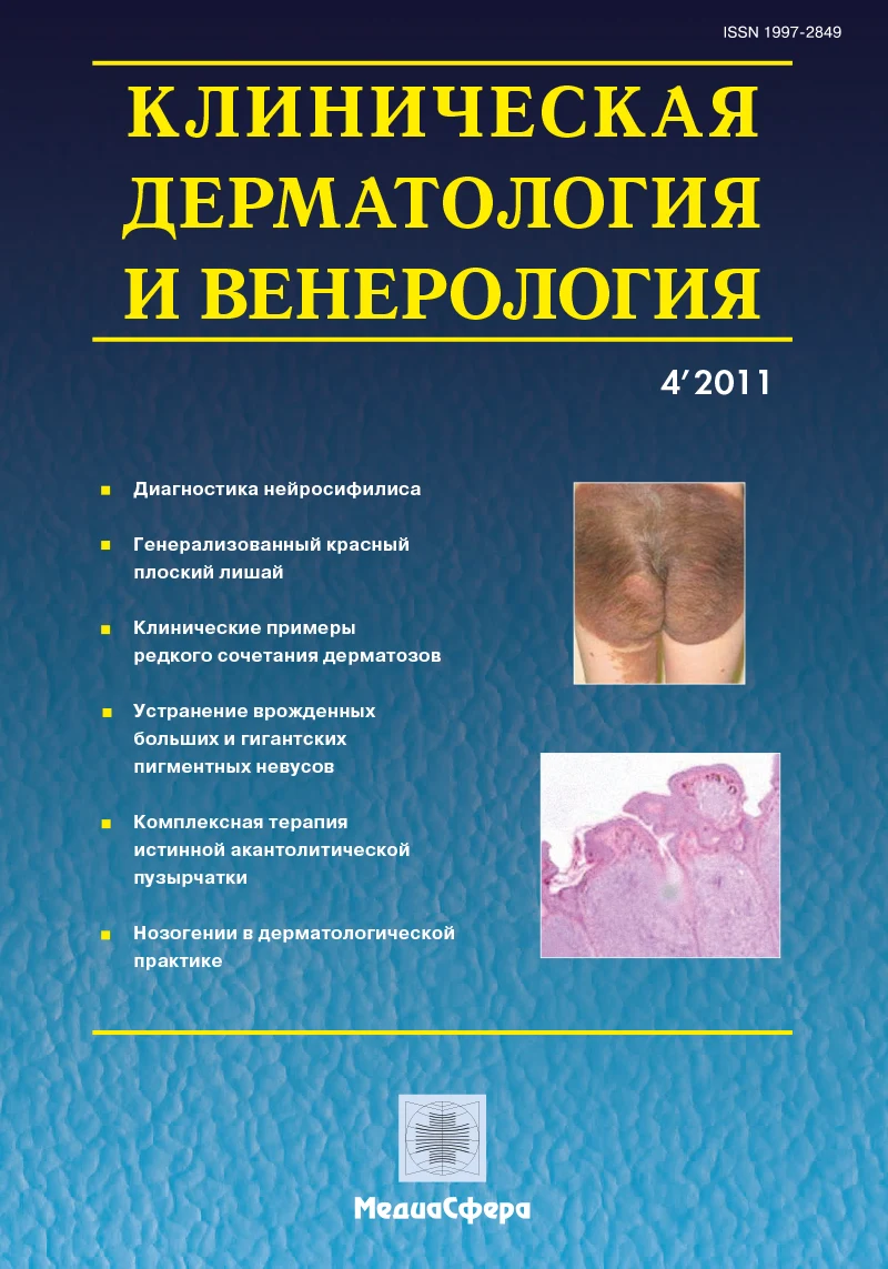 Клинико-лабораторные предикторы и терапия микозов кожи, обусловленных Malassezia spp.