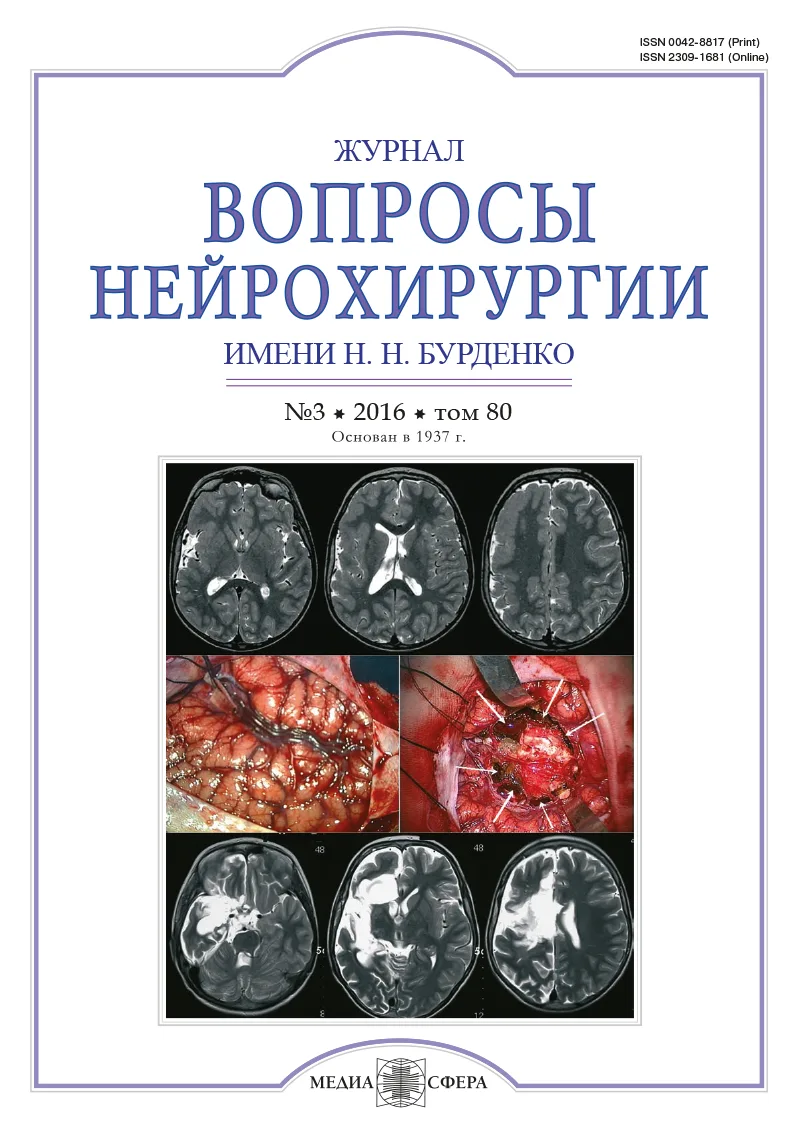 Гемисферэктомия в лечении симптоматической эпилепсии у детей