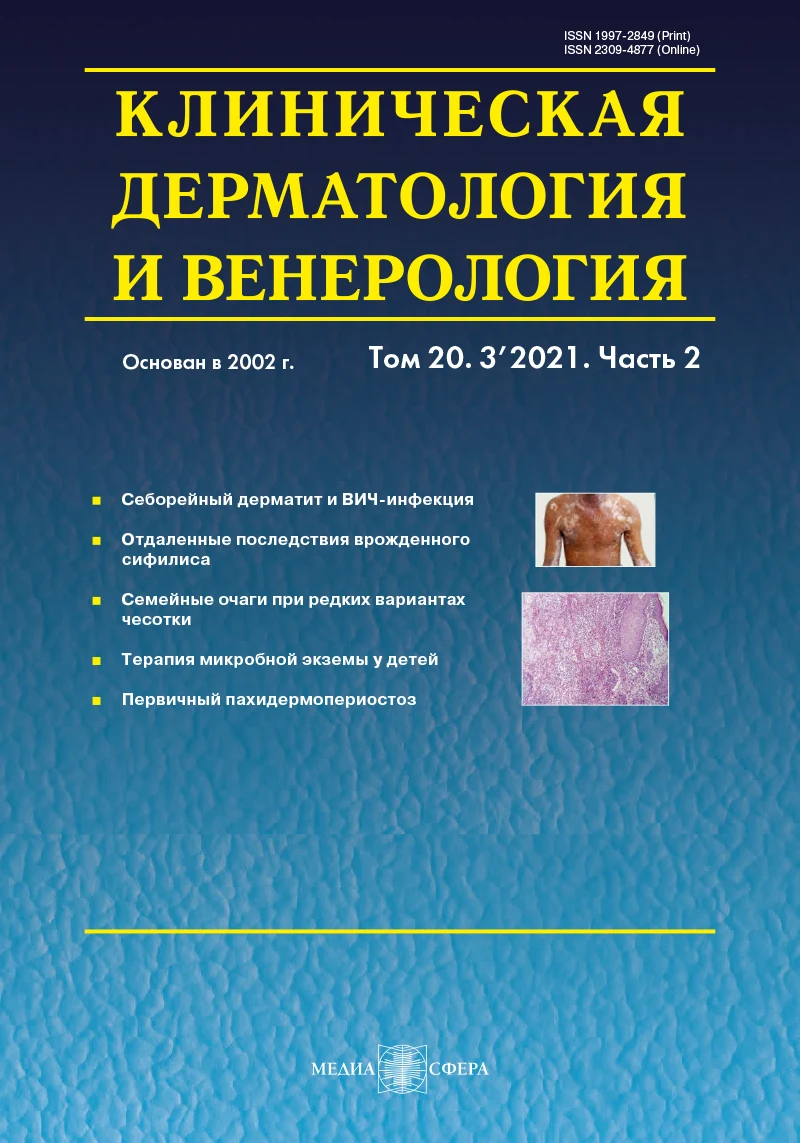 Сочетание себорейного дерматита и ВИЧ-инфекции: обзор литературы с клиническим случаем