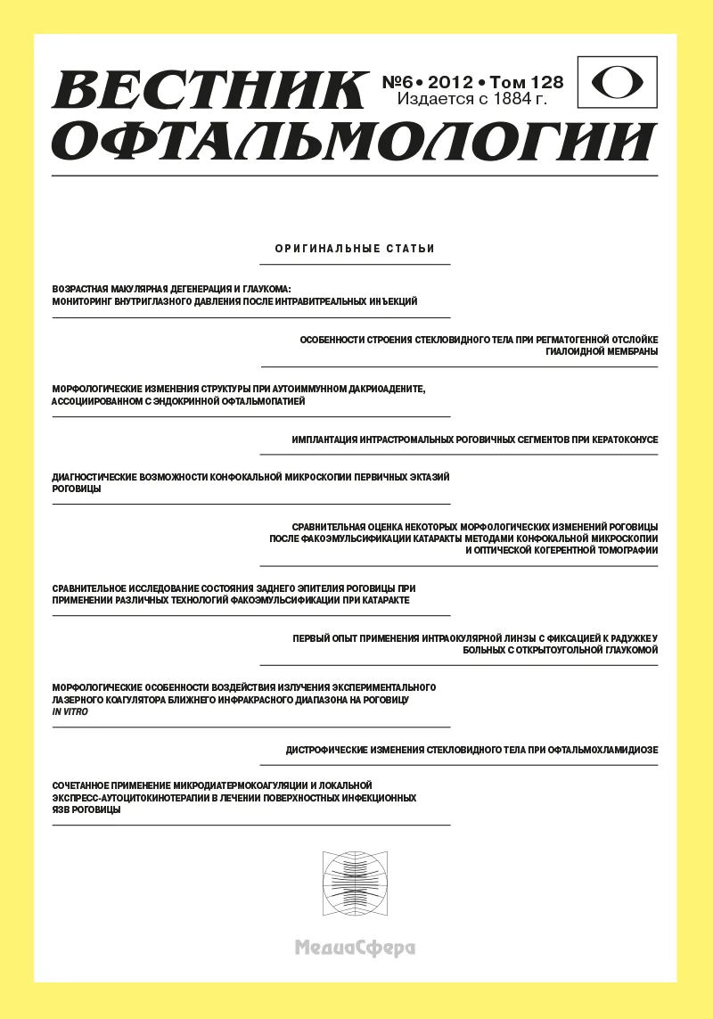 Имплантация интрастромальных роговичных сегментов при кератоконусе