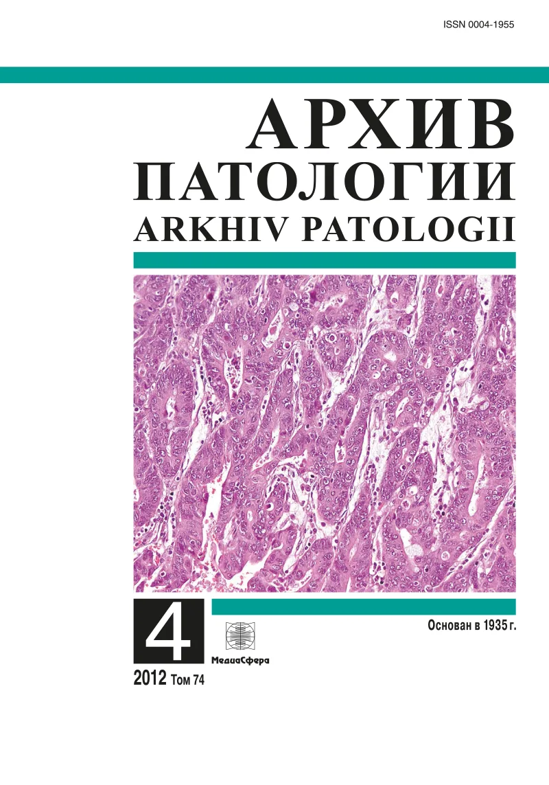 Гипертрофическая кардиомиопатия. Клинико-морфологические сопоставления