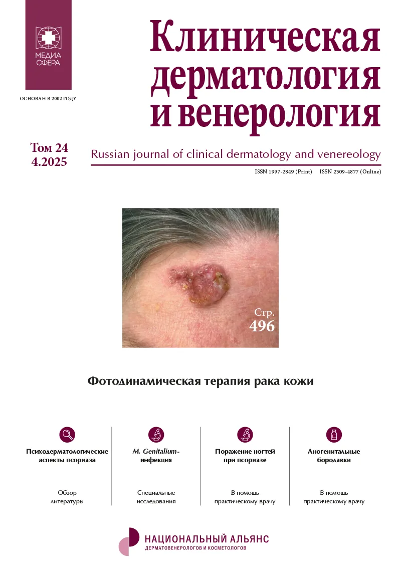 Современные методы терапии латентной формы ВПЧ-инфекции: клиническое наблюдение