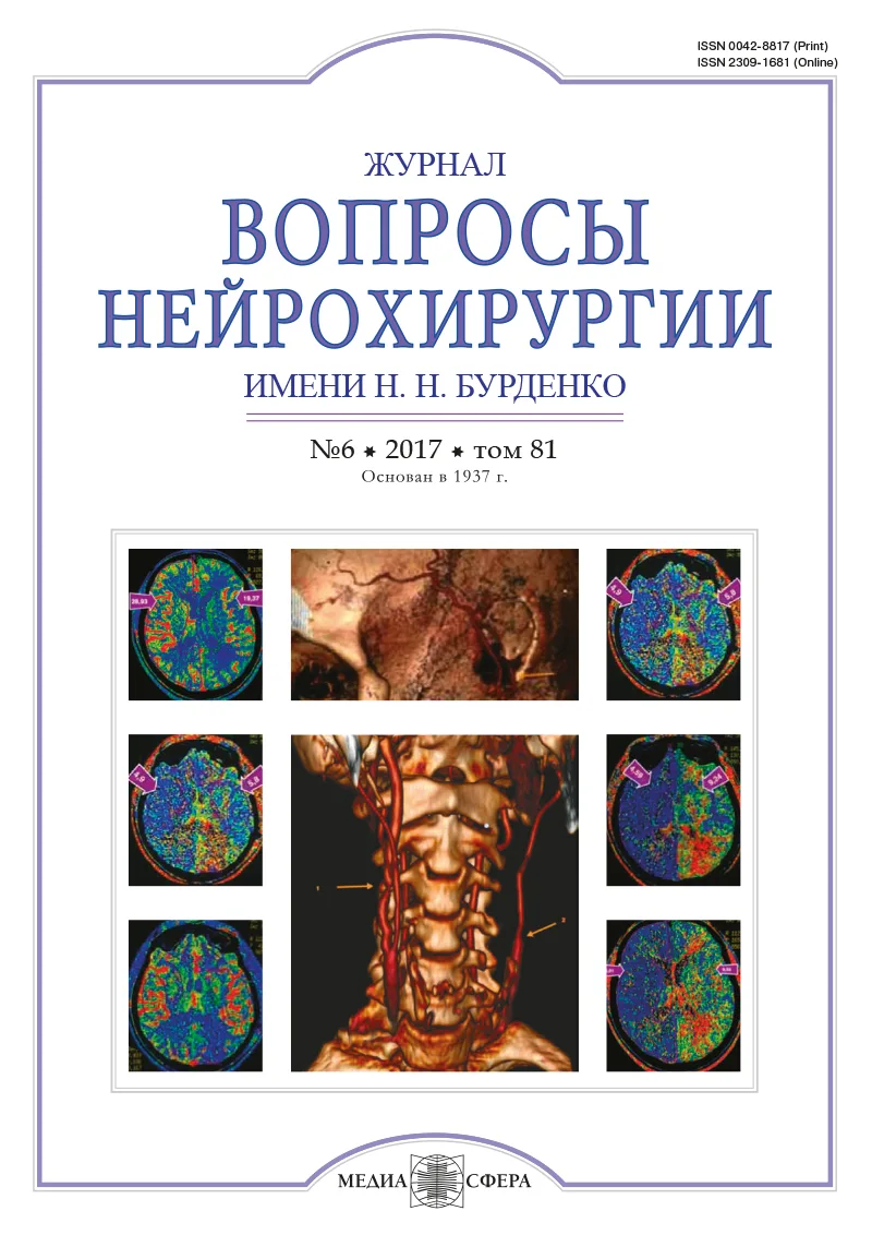 Вопросы нейрохирургии имени Н.Н. Бурденко