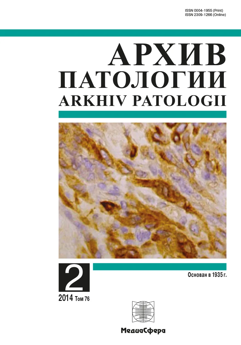 Нарушения ангиогенеза и лимфангиогенеза при сахарном диабете