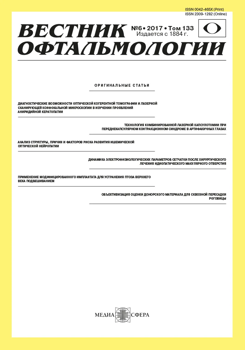 Эндотелиальная дистрофия роговицы Фукса