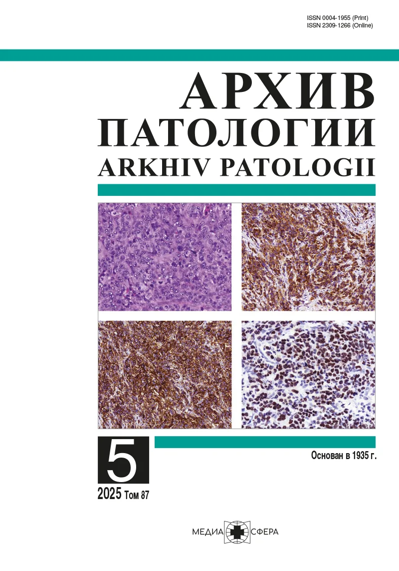 Гетерогенность экспрессии ALDH1, CD133 и CD34 в раковых стволовых клетках аденокарциномы легкого