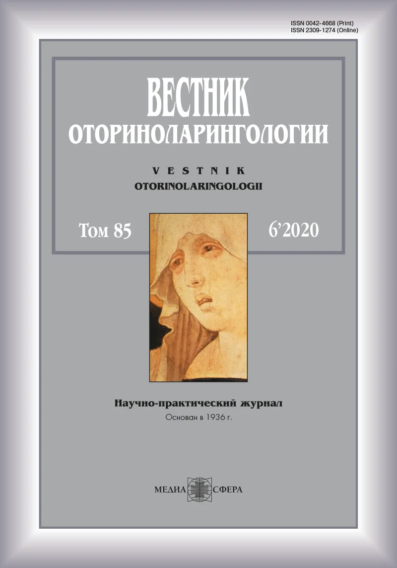 Остеома нижней носовой раковины