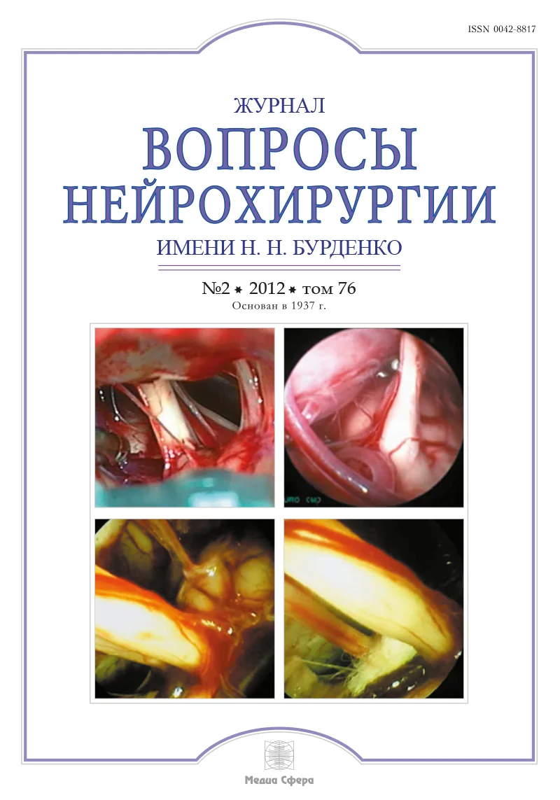 Критическая гидроцефалия у детей (причинные факторы, результаты лечения)