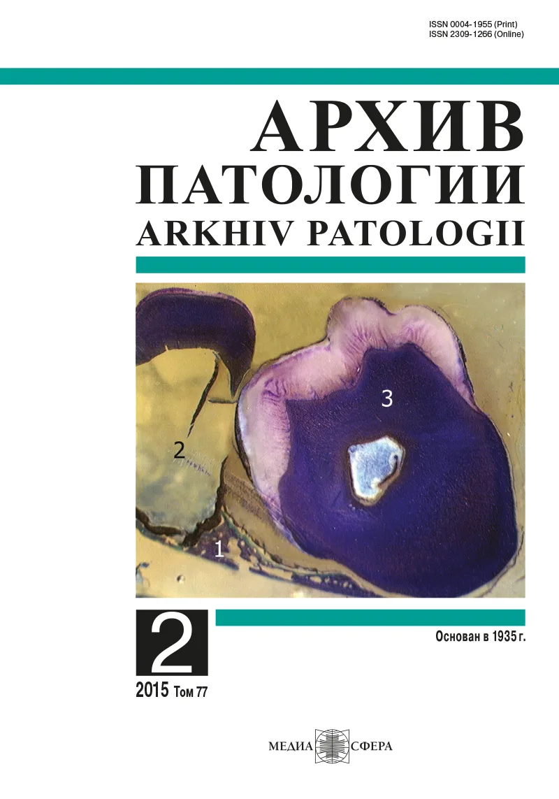 Экспрессия компонентов системы активатора плазминогена в слизистой оболочке желудка при портальной гипертензионной гастропатии