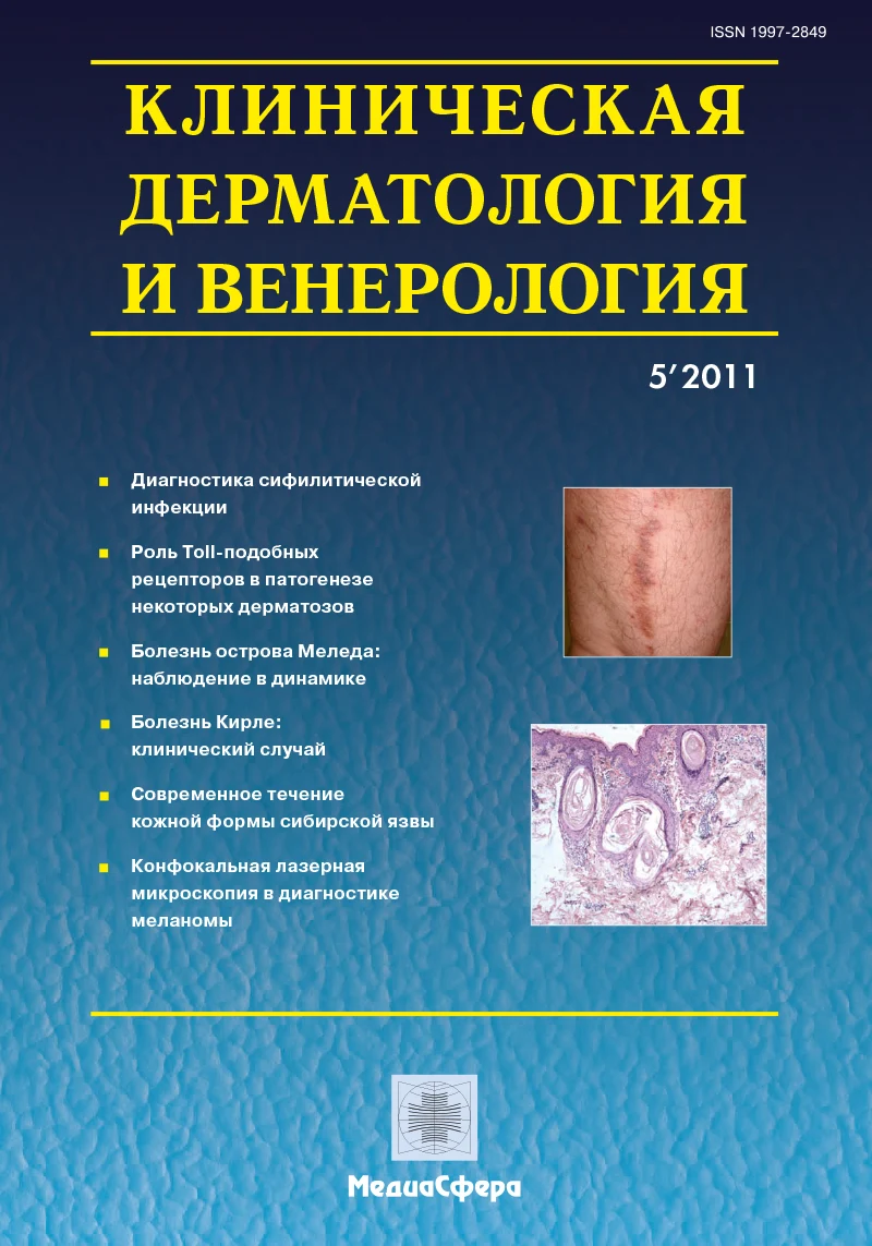Диагностика сифилитической инфекции