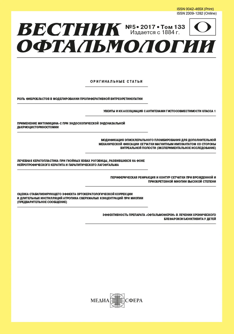Птеригиум: этиология, патогенез, лечение