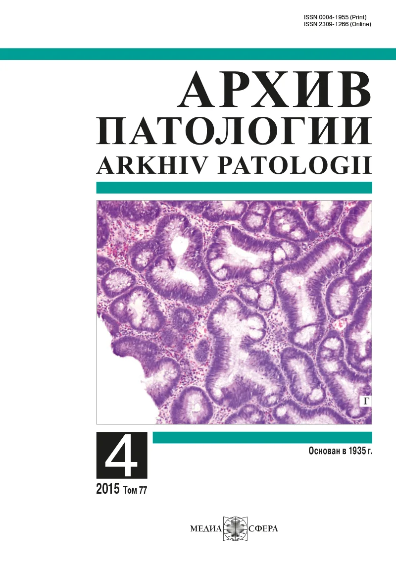 Новая классификация опухолей яичника