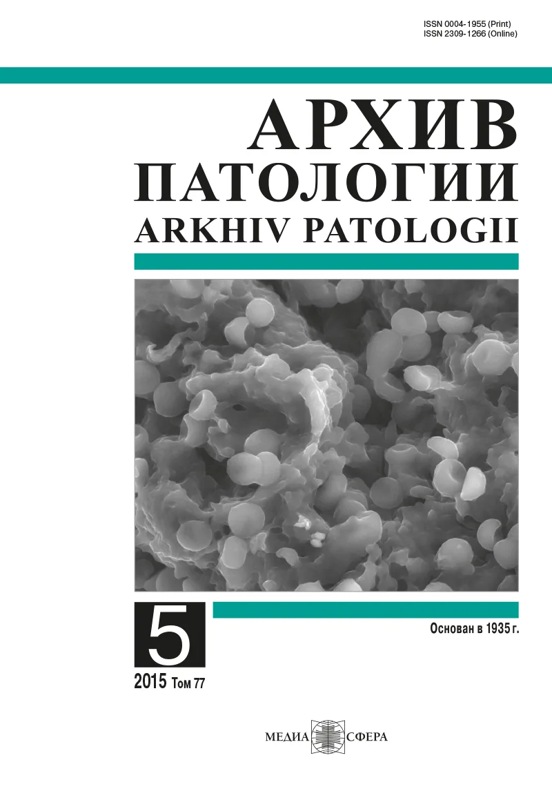 Оптимизация иммуногистохимической диагностики AL-амилоидоза при помощи новых антител