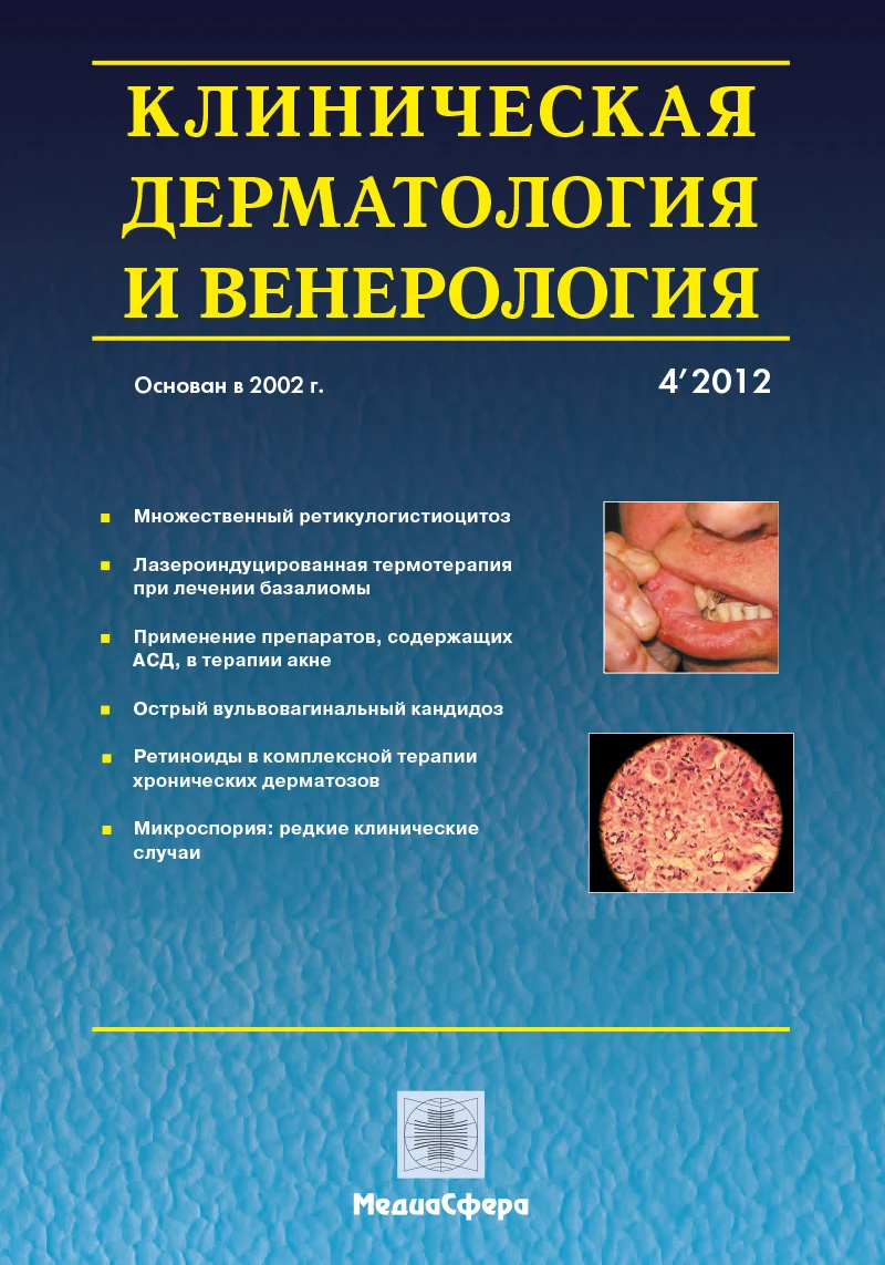 Комплексное лечение генитальной папилломавирусной инфекции