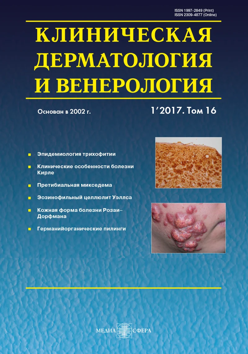 Эозинофильный целлюлит Уэллса: особенности диагностики