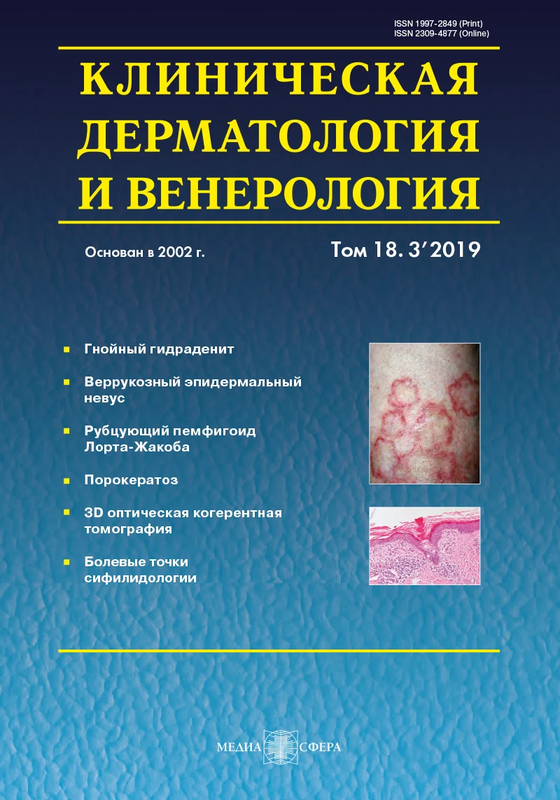 Порокератоз и его клинические варианты