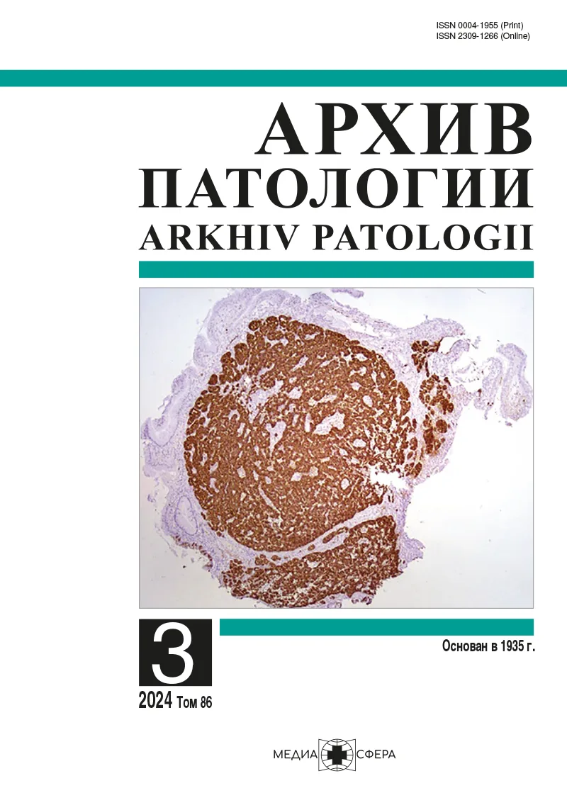 Амплификация гена c-MYC при ацинарной аденокарциноме простаты. Морфогенетические сопоставления